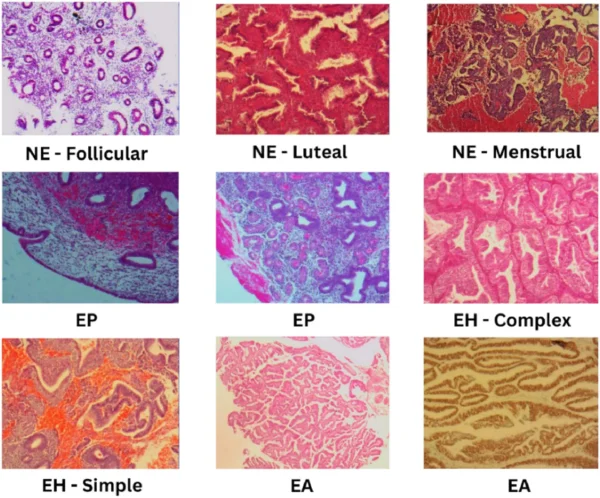 Cancer_Sample_Dataset