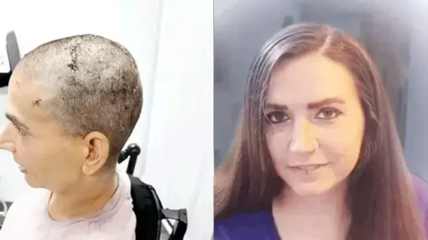 אודרי היא האישה הראשונה שמושתל צ׳יפ במח שלה